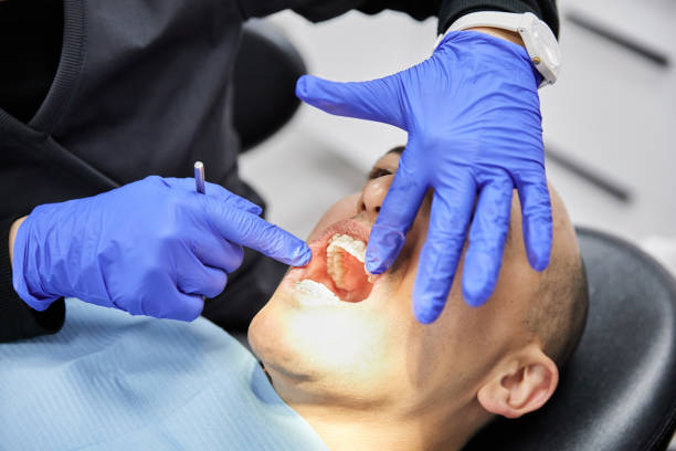 Best Dentist for Tooth Abscess  in Fort Shawnee, OH