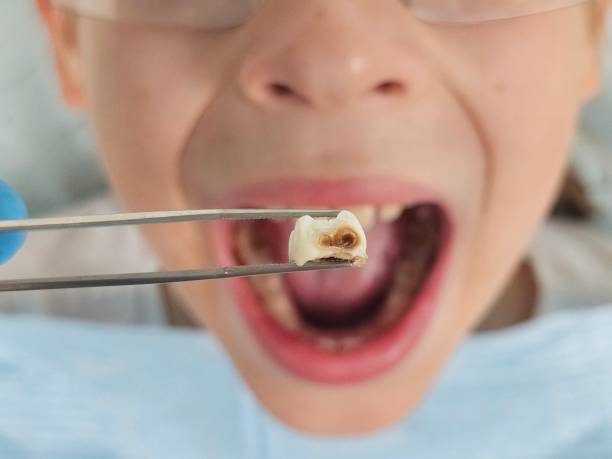 Best Cracked Tooth Emergency Dentist  in Fort Shawnee, OH